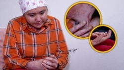 “Күйөөм бензин чачып, өрт койду”. Майрамкүл жардамга муктаж
