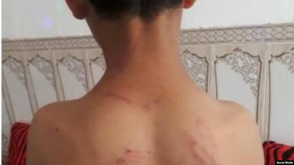 تصویر منتشر شده در وبسایتهای محلی و شبکههای اجتماعی از دانشآموزی که شلاق خورده است
