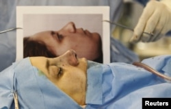 Пластическая операция в одной из клиник Тегерана. Август 2015 года