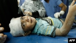 Палестинский ребенок, раненый в результате израильского авианалета. Город Газа