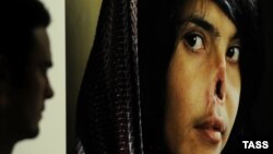 Афганская девушка Биби Аиша, искалеченная собственным мужем за попытку бежать от него