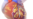 Myocardial Infarction or Heart Attack