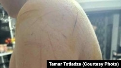 ნაწამები ბიჭის სხეული