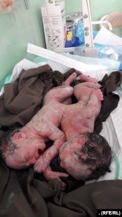 یکی از دوگانگی‌های به‌هم چسپیده که در ولایت هرات متولد شده‌اند.