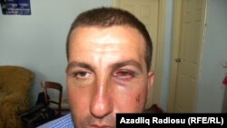 AXCP Naxçıvan təşkilatının sədr əvəzi Yaşar Bağırsoy