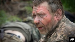 A Ukrainian soldier with a burned face is given first aid by medics on a road near Bakhmut on May 11.