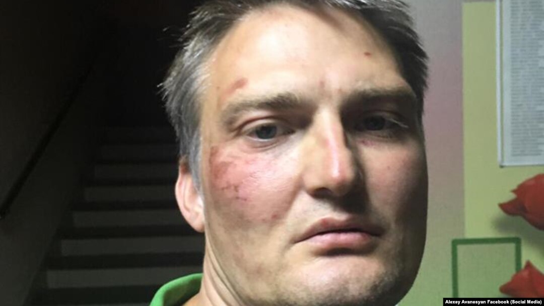 Адвокат Беньяш после избиения