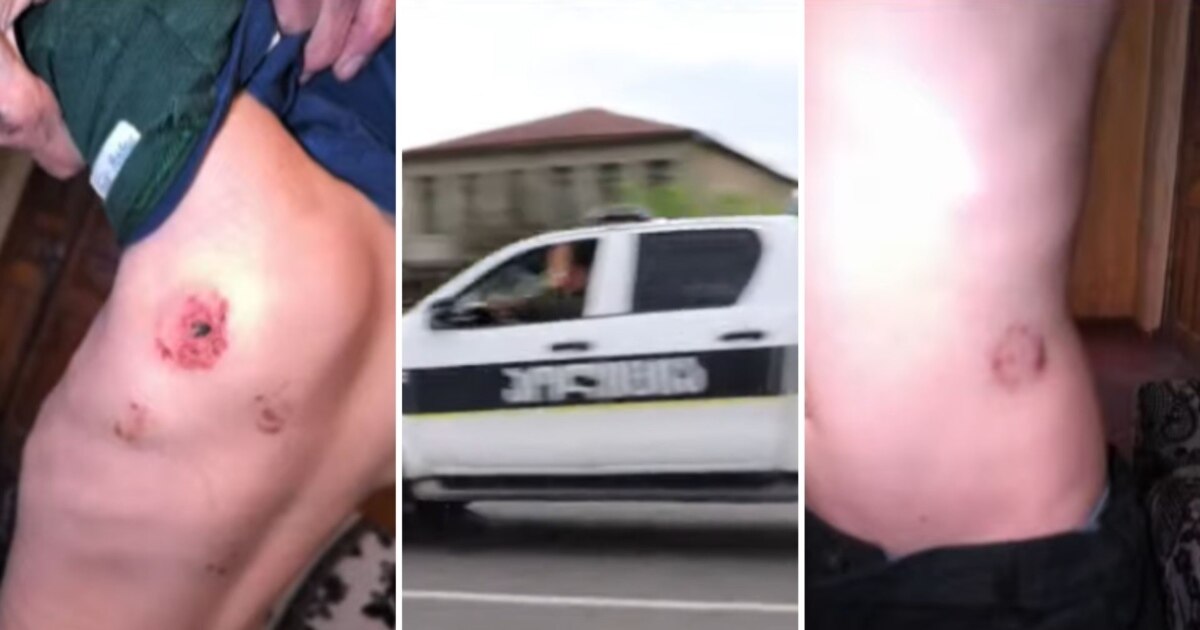 7 წლის ბავშვზე ძალადობის ბრალდებით დედა და ბებია დააკავეს