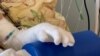 „Arsurile acoperă 40% din corp”. Un băiat supraviețuiește atacului rusesc care i-a ucis mama