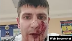 Журналист сайта «Дорожный контроль» Антон Князев в отделении полиции в городе Усть-Каменогорске после инцидента с нападением неизвестных. Август 2022 года