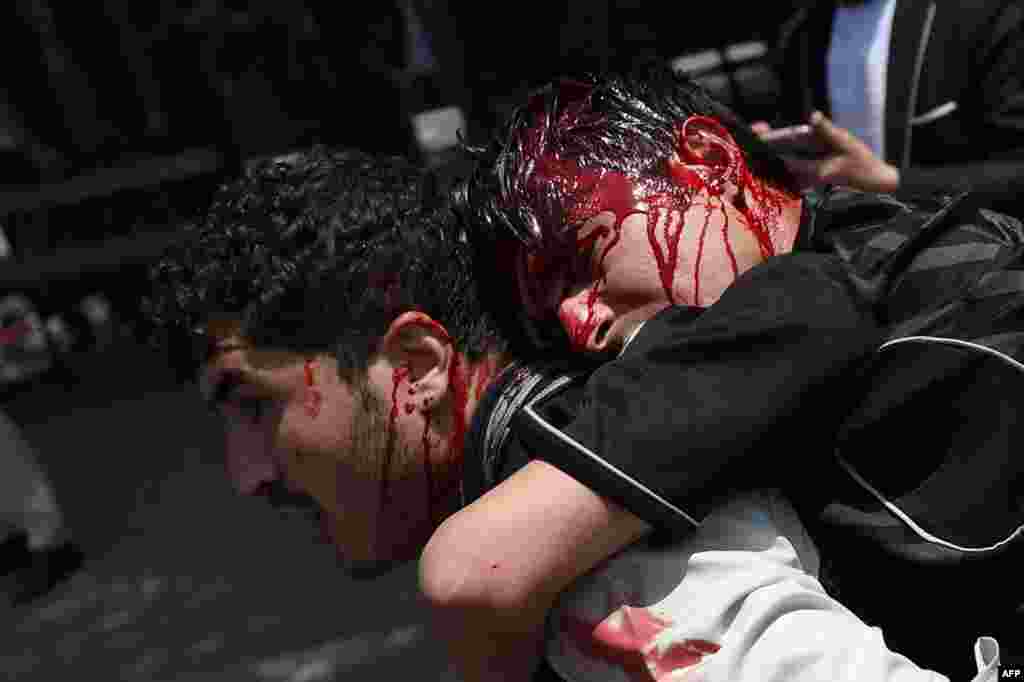 An Afghan protester carries his injured colleague during clashes with Afghan riot police at a demonstration against Taliban militants and the kidnapping of civilians at Shar-e Naw Park in Kabul. Hundreds of Afghans staged a protest in Kabul over recent kidnappings of civilians in northeastern Afghanistan by Taliban insurgents. (AFP/Wakil Kohsar)