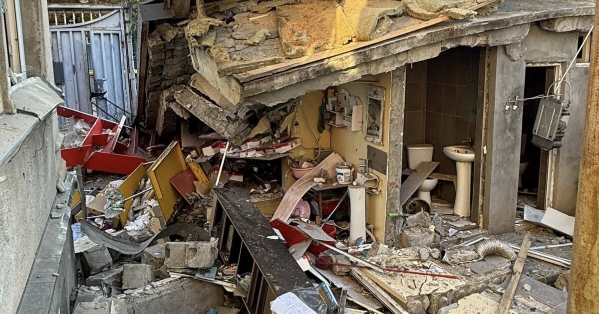 სხეულის 48% აქვს დამწვარი ლოტკინზე მომხდარი აფეთქების დროს დაშავებულ გოგოს