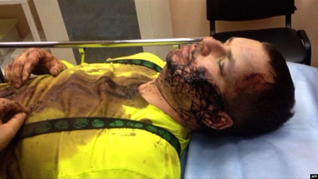 Opposition activist Dmytro Bulatov receives medical attention in Kyiv on January 31.