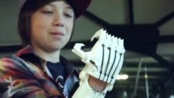 ABŞ-da 3D protezlər