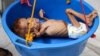A Yemeni child suffering from malnutrition is weighed at a hospital in the northern district of Abs in the northwestern Hajjah Province last year.