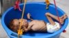سازمان ملل متحد می گوید، ۲۰ میلیون یمنی در گرسنگی به سر می‌برند