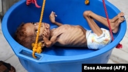 A Yemeni child suffering from malnutrition is weighed at a hospital in the northern district of Abs in the northwestern Hajjah Province last year.