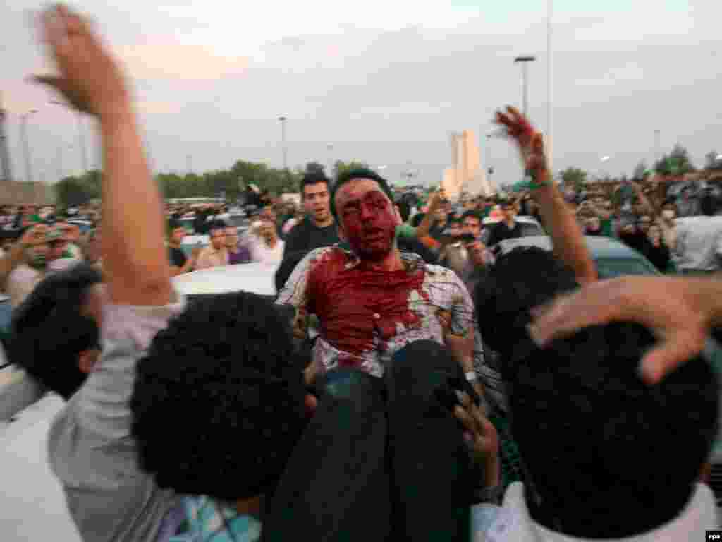 Официальные информационные агентства сообщают о семи убитых в результате столкновений сторонников оппозиции с проправительственной вооруженной группировкой во время демонстраций в понедельник. Многие получили ранения.