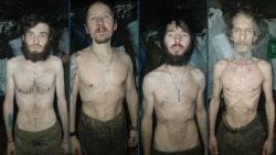 Relatives of soldiers from Ukraine's 14th Separate Mechanized Brigade shared photographs of the emaciated men, prompting outrage -- and later the removal of the brigade's commander. 