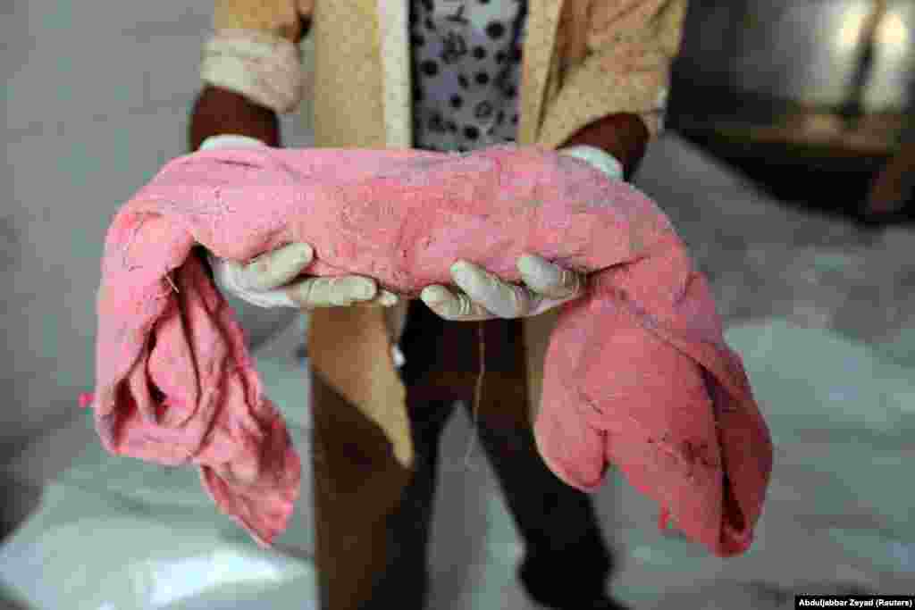 A hospital worker holds the body of an unborn baby whose mother was killed by an air strike in Hodeida, Yemen. (Reuters/Abduljabbar Zeyad)