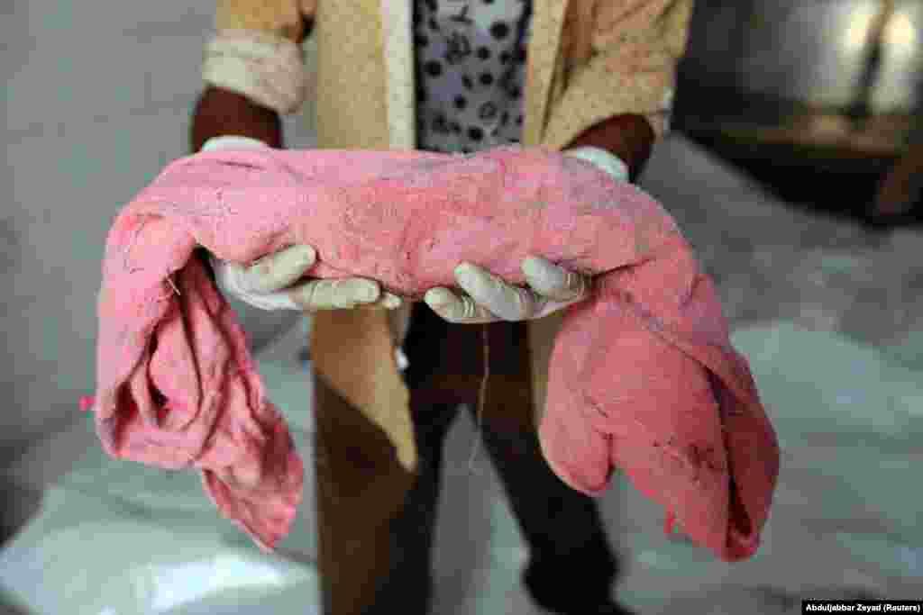 A worker holds the body of an unborn baby whose mother was killed by an airstrike in Hodeida, Yemen, on April 2. (Reuters/Abduljabbar Zeyad)