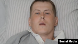 Один из пленных российских спецназовцев Александр Александров в госпитале в Киеве.