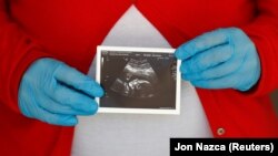 Беременная женщина держит снимок УЗИ. Иллюстративное фото. 