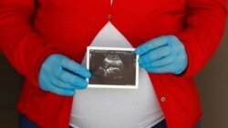 Trudnica u Španiji sa zaštitnim rukavicama, april 2020.