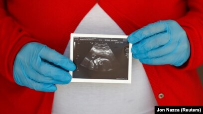 3d беременныя сестра Как умирали роженицы во время пандемии. Рассказывают родственники