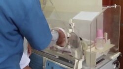 هغه پښې چې په لارې له تګ مخکې پرې شوې