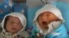 В Китае учёный сообщил о рождении первых детей с изменённой ДНК