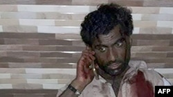 Поранений під час нападу на суфійську святиню, Пакистан, 16 лютого 2017 року 