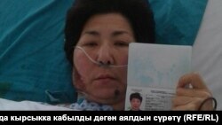 Кырсыкка кабылганы айтылган аял.