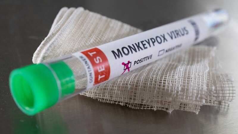 Во Косово сомнителен случај на заразен со мајмунски сипаници