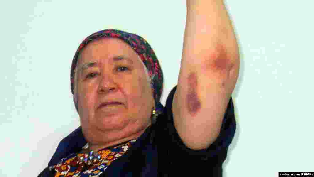 ТУРКМЕНИСТАН - Дописничката на Радио Слободна Европа од Туркменистан Солтан Ахилова повторно била приведена од безбедносните сили на таа земја. Инцидентот се случил на 9 мај кога 68- годишната Ахилова ја сликала церемонијата на положување венец на Вечниот пламен во близина на Меморијалниот центар на жртвите од Втората светска војна. Таа притоа била запрена од неколку лица по што била приведена и било барано од неа да ги избрише снимките. Откако одбила, насилно и бил земен фотоапаратот и избришани сликите. По два часа во притвор таа била ослободена.