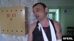 Шахтёр Александр Гуров, подвергшийся пыткам в плену у пророссийских активистов