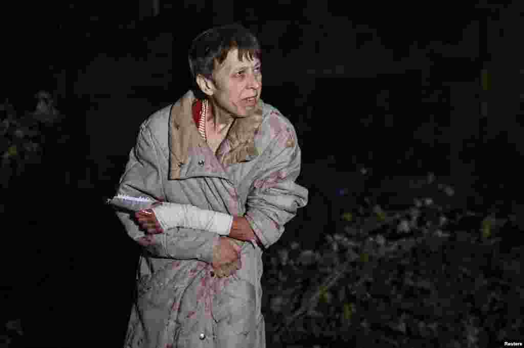 An injured woman is seen next to her apartment building, which was damaged by a Russian air strike, in Zaporizhzhya in southeastern Ukraine.&nbsp;