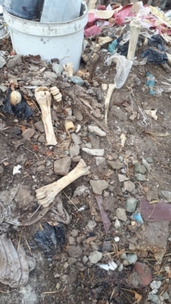 Некоторые бывшие пациенты «Рашида-табиба» утверждают, что костную муку лекарь готовит из костей, найденных в мусорных свалках.