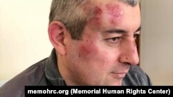 Сиражутдин Дациев после избиения (фото предоставлено "Мемориалом")