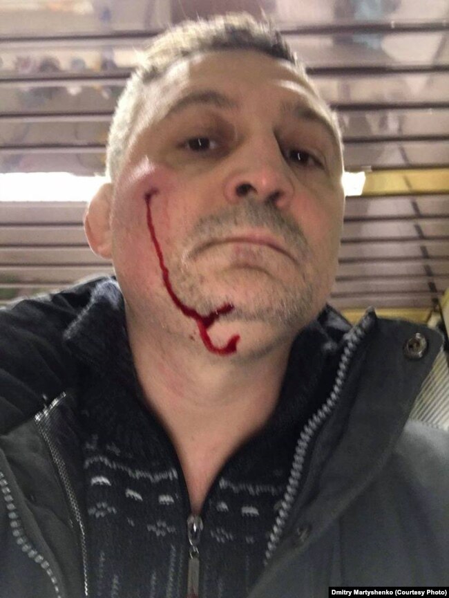 Дмитрий Мартышенко после нападения