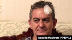 В больнице, куда Али Керимли был доставлен после избиения, ему наложили шесть швов