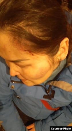 Кайша Акан после нападения на нее. Алматы, 21 января 2021 года.