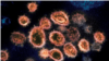 Elektron mikroskop altında SARS-CoV-2 virus hissəcikləri, ABŞ