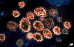Частицы вируса SARS-CoV-2 под электронным микроскопом