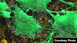 Qelizat kancerogjene (Ilustrim)