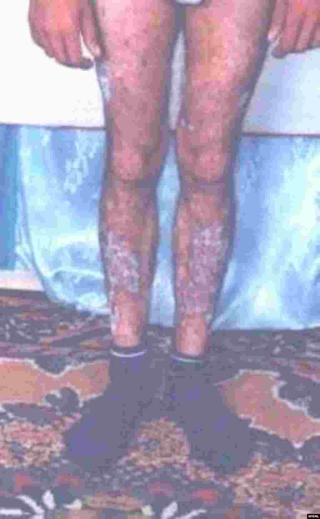 Çernobılın Azərbaycan izləri #6