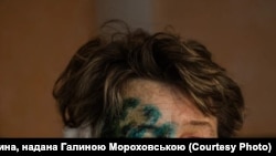 Після поранення