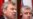 NATO Chief, Russian Lawmaker Spar On Missile Defense