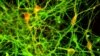 Japan -- Dopaminergic neurons derived from human iPS cell are shown in a photo released by Center for iPS Cell Research and Application, Kyoto University, undated