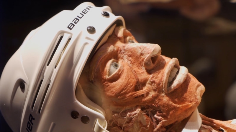 ‘We May Have Public Dismemberments’: Body Worlds Exhibition Under Attack In Moscow